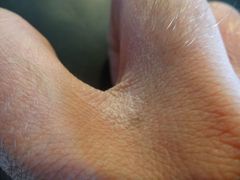 Schuppiges Gesicht und trockene Hände?